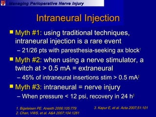 Managing Perioperative Nerve InjuryManaging Perioperative Nerve Injury
Intraneural InjectionIntraneural Injection
 Myth #...