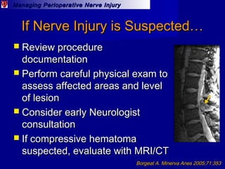 Managing Perioperative Nerve InjuryManaging Perioperative Nerve Injury
If Nerve Injury is Suspected…If Nerve Injury is Sus...