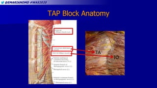 Interfascial Plane Blocks: Should We Believe the Hype? | PPTX