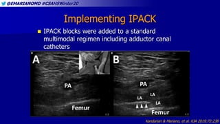 @EMARIANOMD #CSAHSWinter20
Implementing IPACK
 IPACK blocks were added to a standard
multimodal regimen including adducto...