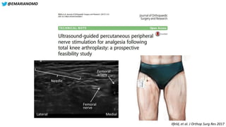 Lessons Learned from the U.S. Opioid Epidemic