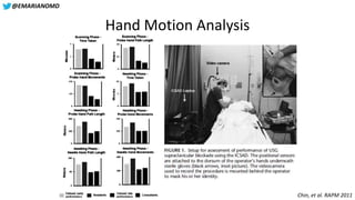 @EMARIANOMD
Hand Motion Analysis
Chin, et al. RAPM 2011
 