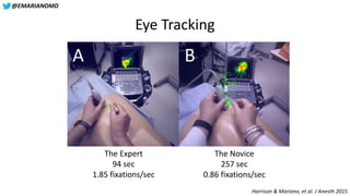 @EMARIANOMD
Eye Tracking
Harrison & Mariano, et al. J Anesth 2015
The Expert
94 sec
1.85 fixations/sec
The Novice
257 sec
...