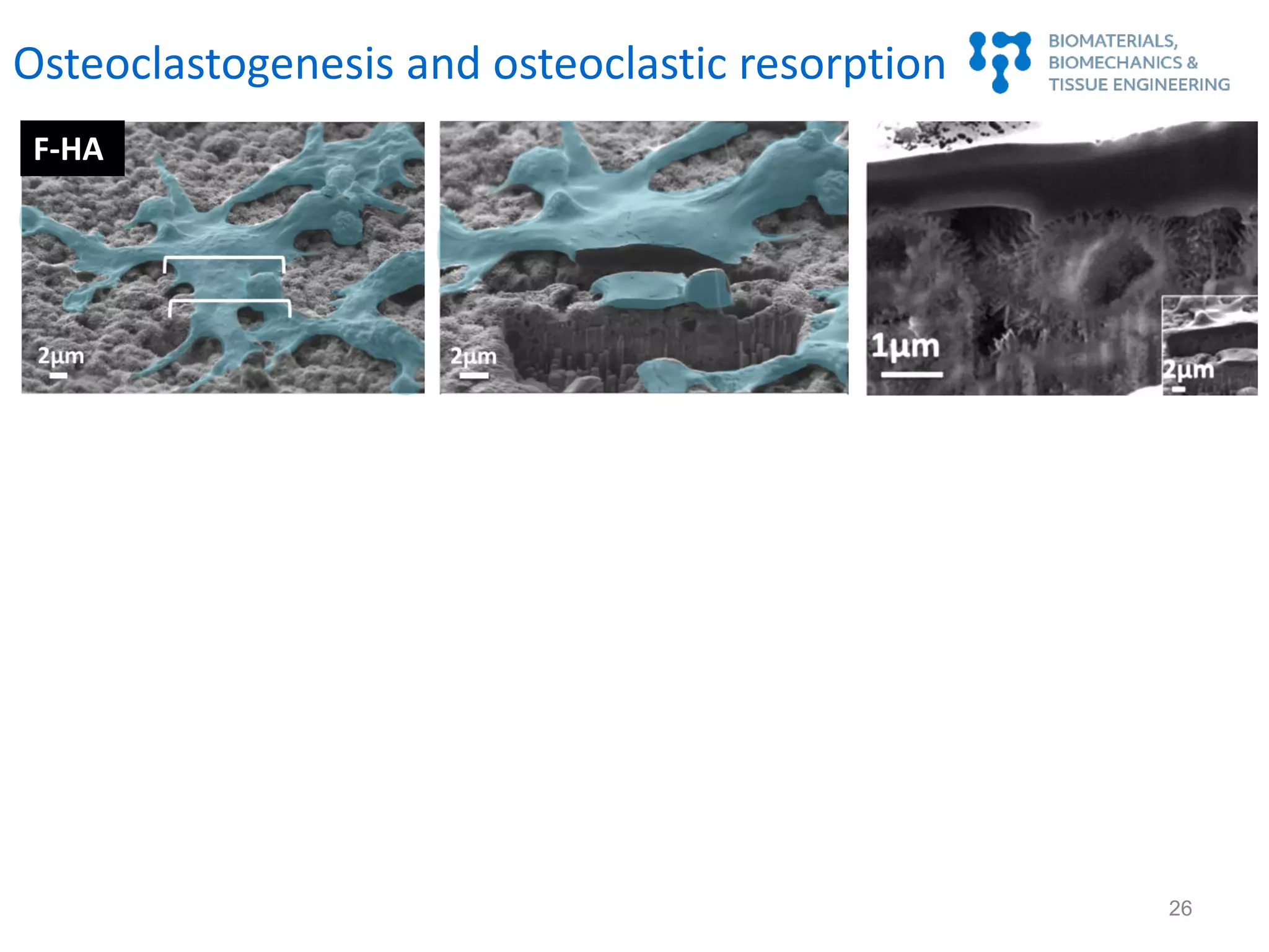 F-HA
Osteoclastogenesis and osteoclastic resorption
26
 