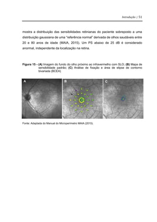 Introdução | 51
mostra a distribuição das sensibilidades retinianas do paciente sobreposto a uma
distribuição gaussiana de uma “referência normal” derivada de olhos saudáveis entre
20 e 80 anos de idade (MAIA, 2015). Um PS abaixo de 25 dB é considerado
anormal, independente da localização na retina.
Figura 15 - (A) Imagem do fundo do olho próximo ao infravermelho com SLO; (B) Mapa de
sensibilidade padrão; (C) Análise de fixação e área de elipse de contorno
bivariada (BCEA)
Fonte: Adaptada do Manual do Microperímetro MAIA (2015).
A B C
 