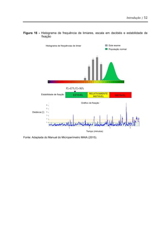 Introdução | 52
Figura 16 - Histograma de frequência de limiares, escala em decibéis e estabilidade de
fixação
Fonte: Adaptada do Manual do Microperímetro MAIA (2015).
 