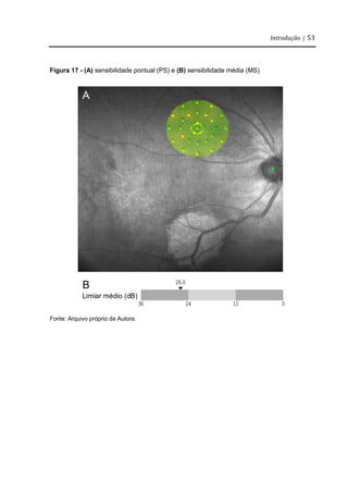 Introdução | 53
Figura 17 - (A) sensibilidade pontual (PS) e (B) sensibilidade média (MS)
Fonte: Arquivo próprio da Autora.
 