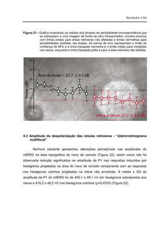 Resultados | 66
Figura 21 - Gráfico mostrando as médias dos limiares de sensibilidade microperimétrica que
se sobrepõem a uma imagem de fundo de olho infravermelha: círculos brancos
com linhas pretas para áreas retinianas não afetadas e linhas vermelhas para
sensibilidades medidas nas lesões. As barras de erro representam o limite de
confiança de 95% e a linha tracejada vermelha é o limite médio para medições
nos nevos, enquanto a linha tracejada preta é para a área retiniana não afetada
4.3 Amplitude da despolarização das células retinianas - “eletrorretinograma
multifocal”
Nenhum paciente apresentou alterações perceptíveis nas amplitudes do
mfERG na área topográfica do nevo de coroide (Figura 22); assim como não foi
observada redução significativa na amplitude de P1 nas respostas induzidas por
hexágonos projetados na área do nevo de coroide comparando com as respostas
nos hexágonos vizinhos projetados na retina não envolvida. A média ± SD da
amplitude de P1 do mfERG foi de 405,1 ± 49,1 nV em hexágonos sobrepostos aos
nevos e 416,2 ± 48,5 nV nos hexágonos vizinhos (p=0,4703) (Figura 22).
 