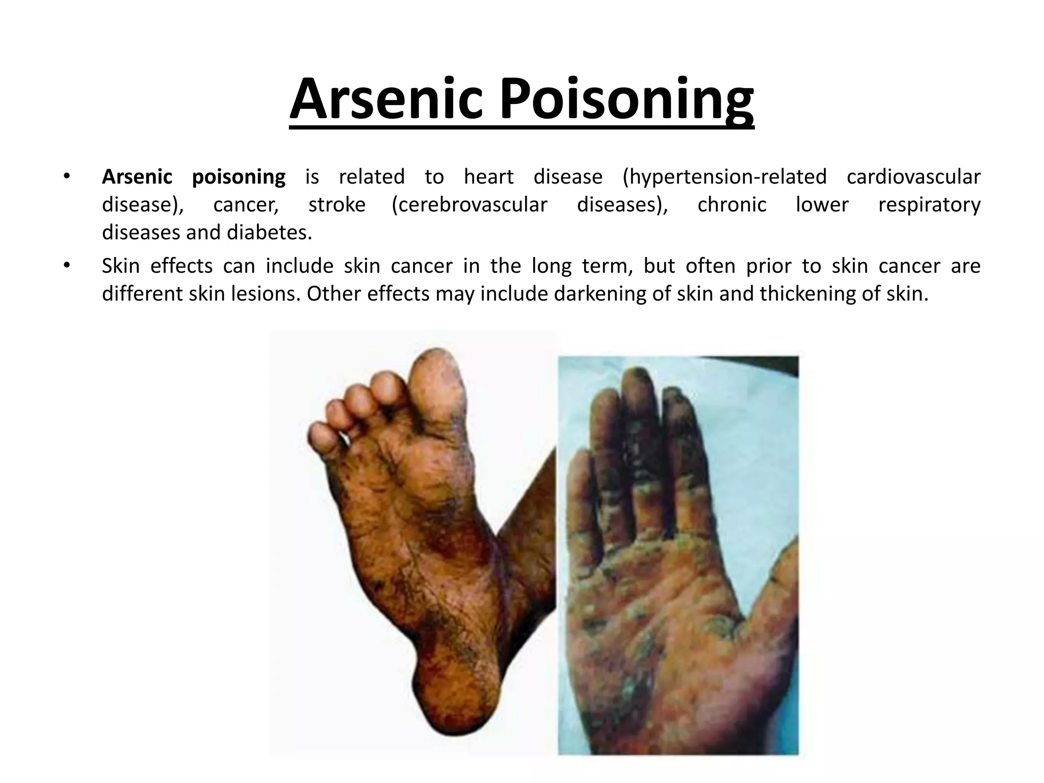 marine-water-pollution-and-diseases-pptx