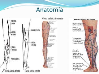 Anatomía
Vena safena interna
 