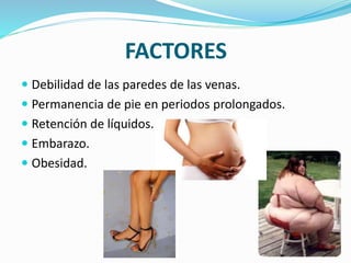 FACTORES
 Debilidad de las paredes de las venas.
 Permanencia de pie en periodos prolongados.
 Retención de líquidos.
 Embarazo.
 Obesidad.
 