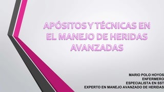 MARIO POLO HOYOS
ENFERMERO
ESPECIALISTA EN SST
EXPERTO EN MANEJO AVANZADO DE HERIDAS
 