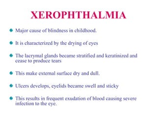 XEROPHTHALMIA
Major cause of blindness in childhood.
It is characterized by the drying of eyes
The lacrymal glands became stratified and keratinized and
cease to produce tears
This make external surface dry and dull.
Ulcers develops, eyelids became swell and sticky
This results in frequent exudation of blood causing severe
infection to the eye.
 