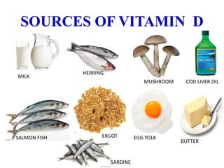 SOURCES OF VITAMIN D
MILK
EGG YOLKERGOT
BUTTER
MUSHROOM COD LIVER OIL
SALMON FISH
HERRING
SARDINE
 
