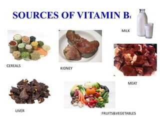 SOURCES OF VITAMIN B1
CEREALS
KIDNEY
LIVER
FRUITS&VEGETABLES
MEAT
MILK
 