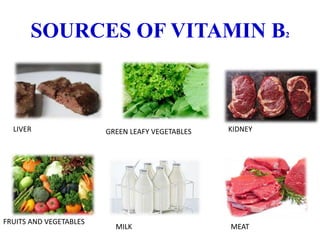 SOURCES OF VITAMIN B2
LIVER GREEN LEAFY VEGETABLES KIDNEY
FRUITS AND VEGETABLES
MILK MEAT
 