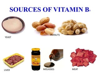 SOURCES OF VITAMIN B7
YEAST
PEANUTS
LIVER MOLASSES MEAT
 