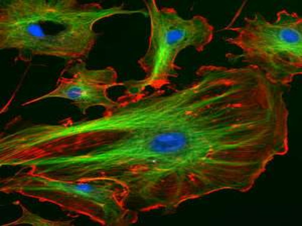 THE CYTOSKELETON
