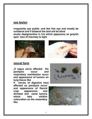 4
eye lesion
irregularity eye pubile. and like fish eye and mostly be
unilateral and if bilateral the bird will be blind
anular depigmention in iris which appearanc as grayish
spot loss of intenisty to light
neural form
.if vagus nerve affected the
paralysis occur and
respiratory manifestion occur
and appearance of tumors on
lung tissue like
if nerves of digestive tract
affected so paralysis occur
and appearance of flaccid
crop appearance and
dirrhaee and some tumors
which take whitich
colouration on the mesentery
like
 