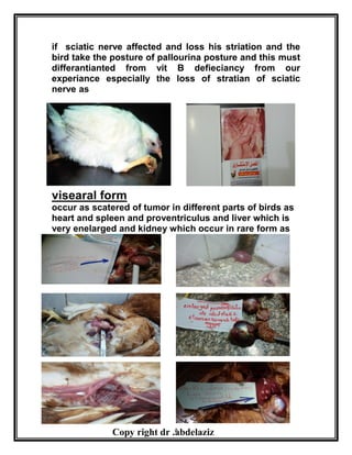 5
if sciatic nerve affected and loss his striation and the
bird take the posture of pallourina posture and this must
differantianted from vit B defieciancy from our
experiance especially the loss of stratian of sciatic
nerve as
visearal form
occur as scatered of tumor in different parts of birds as
heart and spleen and proventriculus and liver which is
very enelarged and kidney which occur in rare form as
Copy right dr .abdelaziz
 