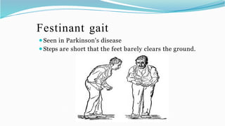 Festinating Physical Therapy for pathological gait.pptx