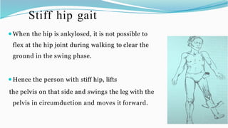 Physical Therapy for pathological gait.pptx