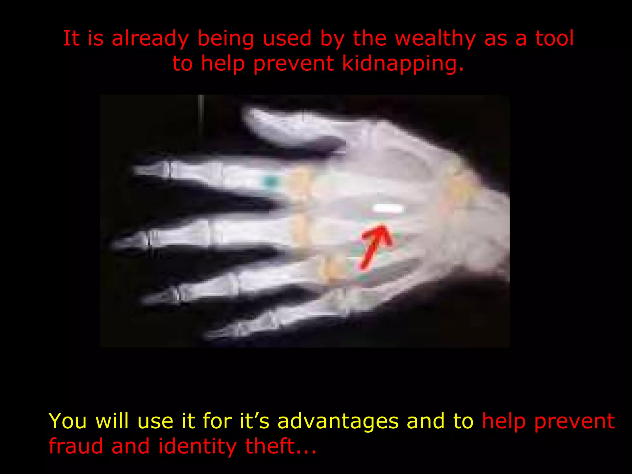 It is already being used by the wealthy as a tool
             to help prevent kidnapping.




You will use it for it’s advantages and to help prevent
fraud and identity theft...
 