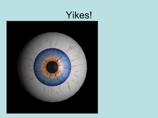 Yikes!
• Sounds painful
 