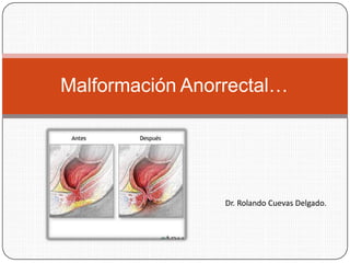 Malformación Anorrectal…
Dr. Rolando Cuevas Delgado.
 