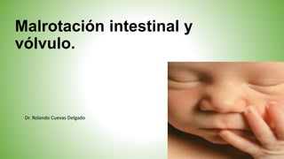 Malrotación intestinal y
vólvulo.
Dr. Rolando Cuevas Delgado
 