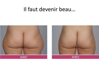 Il faut devenir beau…
 