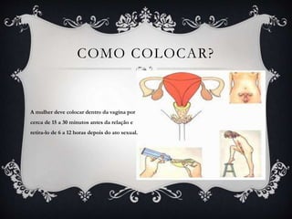 COMO COLOCAR?
A mulher deve colocar dentro da vagina por
cerca de 15 a 30 minutos antes da relação e
retira-lo de 6 a 12 horas depois do ato sexual.
 