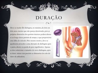 DURAÇÃO
Deve-se mudar de diafragma, no máximo, de dois em
dois anos, mesmo que não pareça deteriorado, pois as
próprias dimensões dos genitais internos podem alterar-
se ao longo desse período de tempo, o que proporciona
uma falha do método. Pelo mesmo motivo, deve-se
igualmente proceder a uma alteração de diafragma após
o parto, aborto ou perda de peso significativo. Apenas
se deve selecionar o tamanho do novo diafragma, após
se deter- minar com precisão as dimensões do colo do
útero da utilizadora.
 