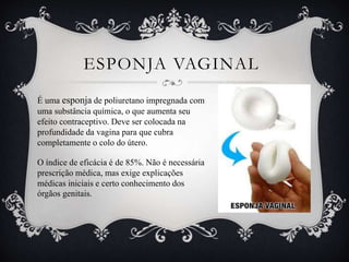 ESPONJA VAGINAL
É uma esponja de poliuretano impregnada com
uma substância química, o que aumenta seu
efeito contraceptivo. Deve ser colocada na
profundidade da vagina para que cubra
completamente o colo do útero.
O índice de eficácia é de 85%. Não é necessária
prescrição médica, mas exige explicações
médicas iniciais e certo conhecimento dos
órgãos genitais.
 