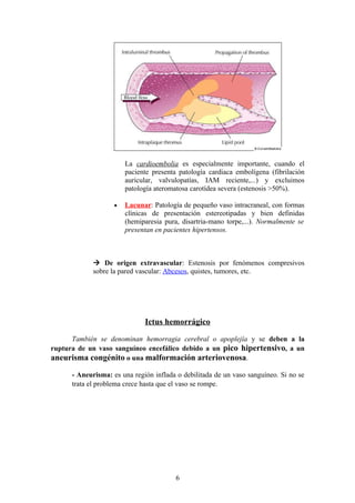 La cardioembolia es especialmente importante, cuando el
                        paciente presenta patología cardiaca embolígena (fibrilación
                        auricular, valvulopatías, IAM reciente,...) y excluimos
                        patología ateromatosa carotídea severa (estenosis >50%).

                    •   Lacunar: Patología de pequeño vaso intracraneal, con formas
                        clínicas de presentación estereotipadas y bien definidas
                        (hemiparesia pura, disartria-mano torpe,...). Normalmente se
                        presentan en pacientes hipertensos.



              De origen extravascular: Estenosis por fenómenos compresivos
             sobre la pared vascular: Abcesos, quistes, tumores, etc.




                              Ictus hemorrágico

      También se denominan hemorragia cerebral o apoplejía y se deben a la
ruptura de un vaso sanguíneo encefálico debido a un pico hipertensivo, a un
aneurisma congénito o una malformación arteriovenosa.

      - Aneurisma: es una región inflada o debilitada de un vaso sanguíneo. Si no se
      trata el problema crece hasta que el vaso se rompe.




                                         6
 
