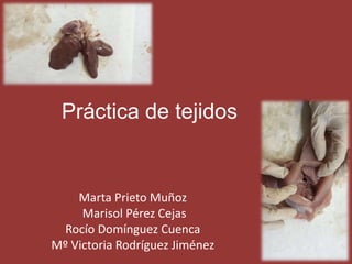 Práctica de tejidos
Marta Prieto Muñoz
Marisol Pérez Cejas
Rocío Domínguez Cuenca
Mº Victoria Rodríguez Jiménez
 