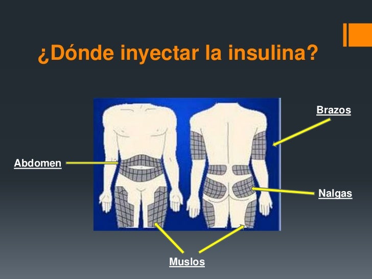 Marta. Insulina Marta. Insulina