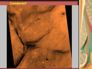 Conducte?
 