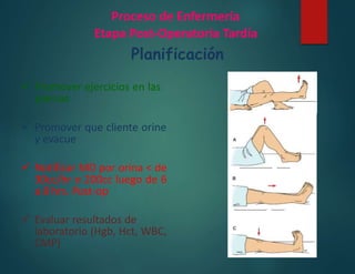 Proceso de Enfermería
Etapa Post-Operatoria Tardía
Planificación
 Promover ejercicios en las
piernas
 Promover que cliente orine
y evacue
 Notificar MD por orina < de
30cc/hr o 200cc luego de 6
a 8 hrs. Post-op
 Evaluar resultados de
laboratorio (Hgb, Hct, WBC,
CMP)
 