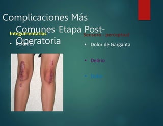 Complicaciones Más
Comunes Etapa Post-
Operatoria
Integumentarias
• Keloides
Sensoro - perceptual
• Dolor de Garganta
• Delirio
• Dolor
 