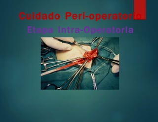 Cuidado Peri-operatorio
Etapa Intra-Operatoria
 