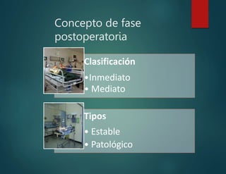 Concepto de fase
postoperatoria
Clasificación
•Inmediato
• Mediato
Tipos
• Estable
• Patológico
 