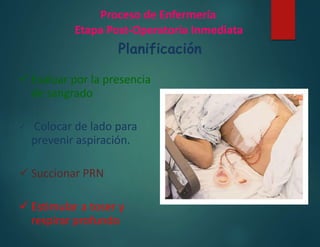 Proceso de Enfermería
Etapa Post-Operatoria Inmediata
Planificación
 Evaluar por la presencia
de sangrado
 Colocar de lado para
prevenir aspiración.
 Succionar PRN
 Estimular a toser y
respirar profundo
 