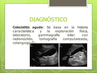 DIAGNÓSTICO
Colecistitis aguda: Se basa en
característica y la exploración
la historia
física,
laboratorio, biliar con
radionúclido,
gammagrafía
tomografía computarizada,
colangiografía.
 
