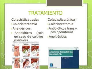 TRATAMIENTO
Colecistitiscrónica:
🞇 Colecistectomía
🞇 Antibióticos trans y
pos operatorios
🞇 Analgésicos
Colecistitisaguda:
🞇 Colecistectomía
🞇 Analgésicos
🞇 Antibióticos (solo
en caso de cultivos
positivos)
 