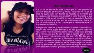 #Sin Brackets
Fue un 18 de Marzo de 2018 cuando por fin me quitaron los
brackets después de dos años y medio , ya que en mi sesión de
fotos no quería salir con dientes de hojalata. Al momento que
me quitaron los brackets me empezó a doler bastante y que
empiezo a gritar en el consultorio, pero ya cuando el Dentista
dice que te mires al espejo, sonríes y sientes un gran descanso
y te miras al espejo y te das cuenta que si valieron la pena los
dos años de sufrimiento.
Al llegar a mi casa me quedaba viendo al espejo durante mucho
tiempo, me sentía súper diferente y no me gustaba como me
veía, se me veían los dientes como conejo, ósea súper grandes
de lo normal. Así que fui con mi papa a decirle que si me los
volvía a poner y obviamente me dijo que no. Me dijo que si
estaba loca o que, y pues yo le dije que me veía súper mal pero
después mi papa me levanto mi autoestima diciéndome que era
la única con dientes perfectos de la familia Alejandre (familia
parte de mi mama). Así que me tome una foto para asesorarme
y ver que si tenia dientes grandes pero derechitos y bonitos.
MENU
 