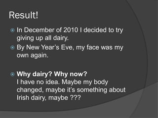 Result!
 In December of 2010 I decided to try
  giving up all dairy.
 By New Year’s Eve, my face was my
  own again.

   Why dairy? Why now?
    I have no idea. Maybe my body
    changed, maybe it’s something about
    Irish dairy, maybe ???
 