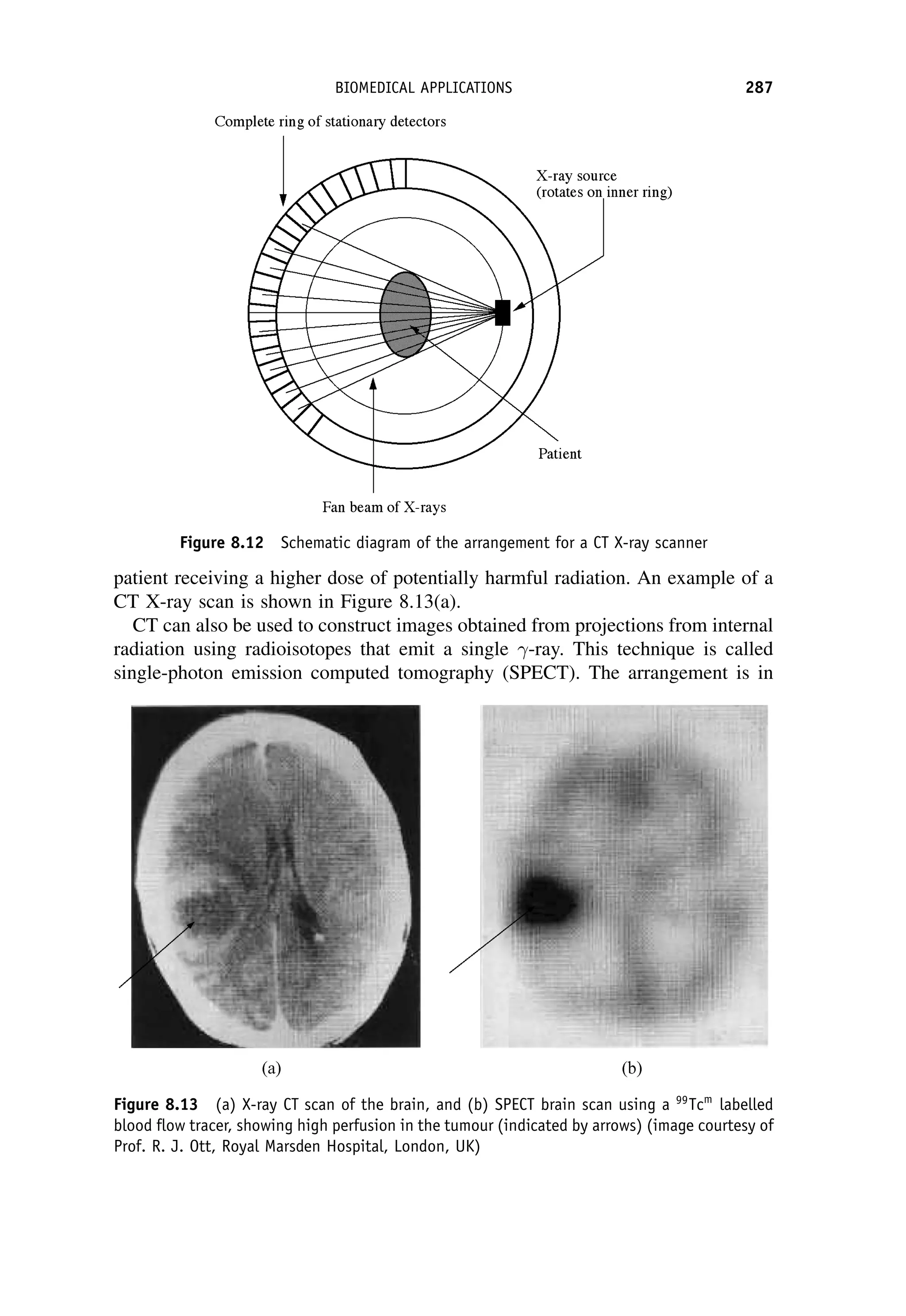 patient receiving a higher dose of potentially harmful radiation. An example of a
CT X-ray scan is shown in Figure 8.13(a).
CT can also be used to construct images obtained from projections from internal
radiation using radioisotopes that emit a single -ray. This technique is called
single-photon emission computed tomography (SPECT). The arrangement is in
Figure 8.12 Schematic diagram of the arrangement for a CT X-ray scanner
Figure 8.13 (a) X-ray CT scan of the brain, and (b) SPECT brain scan using a 99
Tcm
labelled
blood flow tracer, showing high perfusion in the tumour (indicated by arrows) (image courtesy of
Prof. R. J. Ott, Royal Marsden Hospital, London, UK)
BIOMEDICAL APPLICATIONS 287
 