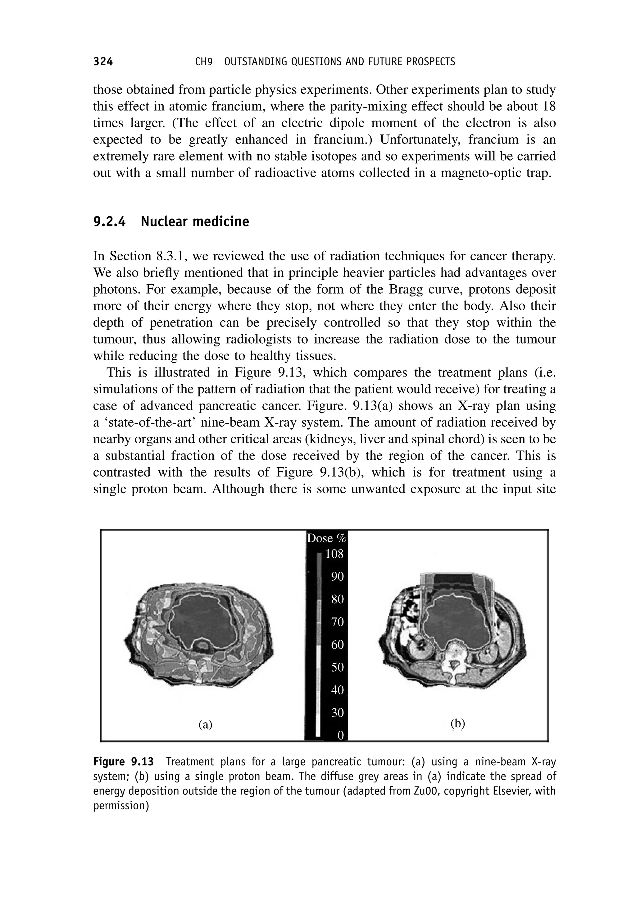 those obtained from particle physics experiments. Other experiments plan to study
this effect in atomic francium, where the parity-mixing effect should be about 18
times larger. (The effect of an electric dipole moment of the electron is also
expected to be greatly enhanced in francium.) Unfortunately, francium is an
extremely rare element with no stable isotopes and so experiments will be carried
out with a small number of radioactive atoms collected in a magneto-optic trap.
9.2.4 Nuclear medicine
In Section 8.3.1, we reviewed the use of radiation techniques for cancer therapy.
We also briefly mentioned that in principle heavier particles had advantages over
photons. For example, because of the form of the Bragg curve, protons deposit
more of their energy where they stop, not where they enter the body. Also their
depth of penetration can be precisely controlled so that they stop within the
tumour, thus allowing radiologists to increase the radiation dose to the tumour
while reducing the dose to healthy tissues.
This is illustrated in Figure 9.13, which compares the treatment plans (i.e.
simulations of the pattern of radiation that the patient would receive) for treating a
case of advanced pancreatic cancer. Figure. 9.13(a) shows an X-ray plan using
a ‘state-of-the-art’ nine-beam X-ray system. The amount of radiation received by
nearby organs and other critical areas (kidneys, liver and spinal chord) is seen to be
a substantial fraction of the dose received by the region of the cancer. This is
contrasted with the results of Figure 9.13(b), which is for treatment using a
single proton beam. Although there is some unwanted exposure at the input site
Figure 9.13 Treatment plans for a large pancreatic tumour: (a) using a nine-beam X-ray
system; (b) using a single proton beam. The diffuse grey areas in (a) indicate the spread of
energy deposition outside the region of the tumour (adapted from Zu00, copyright Elsevier, with
permission)
324 CH9 OUTSTANDING QUESTIONS AND FUTURE PROSPECTS
 
