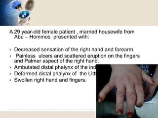 Syringomyelia ( Morvan syndrome) Electrodiagnosis | PPT